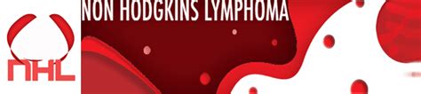 Non Hodgkins Lymphoma Description Symptoms Diagnosis Treatment