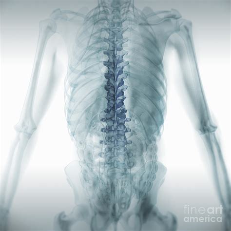Spinal Anatomy Photograph By Science Picture Co Pixels