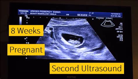 ⭐️ best dating scan at 7 weeks 5 days pregnant 2019 👉👌first ultrasound 7 weeks 6 days youtube