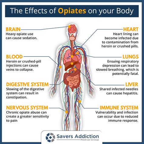 The Effects Of Opiates On Your Body Infographic Savers Addiction