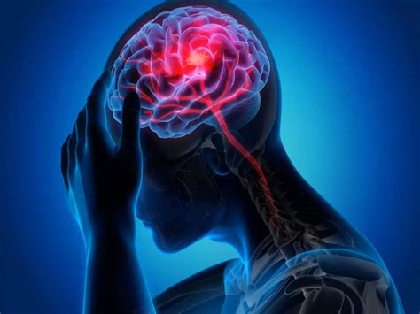 Stroke Symptoms Mini Stroke Signs Like Sudden Delirium Can Appear A