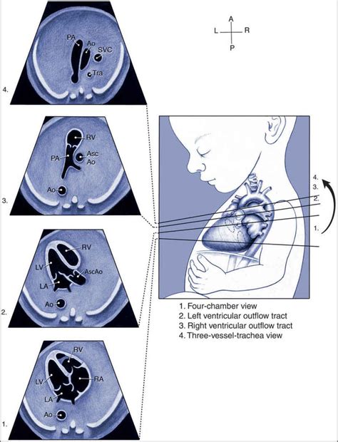 Guidelines For The Performance Of The Sonographic Screening And