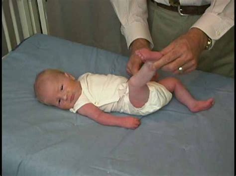 Neurologic Exam Pediatric Newborn Abnormal Tone Leg Traction