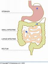 What Causes Stomach Discomfort And Gas