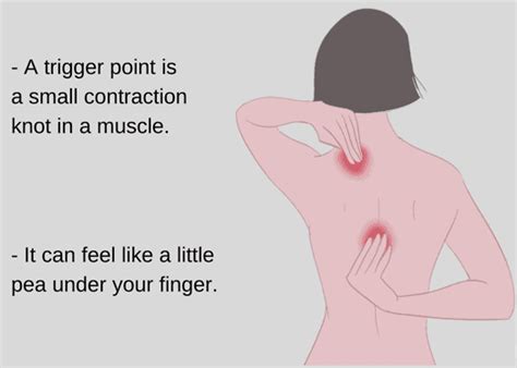 What Happens When A Trigger Point Is Released Mike Gillis Rmt Moncton Massage Therapy