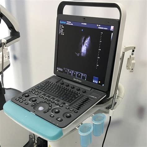Sonoscape S8 Portable Ultrasound Laksamana Karya