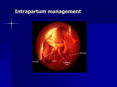 Ppt Intrapartum Management Powerpoint Presentation Id337902