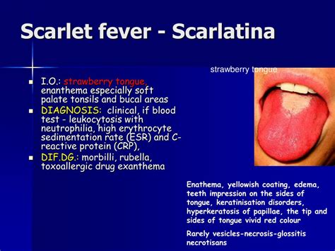 Ppt Manifestation Of Bacterial And Viral Diseases In Oral Cavity