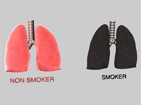 Human Lungs Smokers 3d C4d