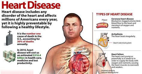 Types Of Heart Disease Infographic
