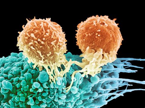 Immunotherapy Offers Hope For Some Men With Aggressive Prostate Cancer