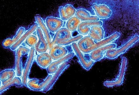 Marburg virus disease is transmitted to people from fruit bats and spreads between humans through the transmission of bodily fluids. Researchers Identify Possible Marburg And Ebola Virus ...