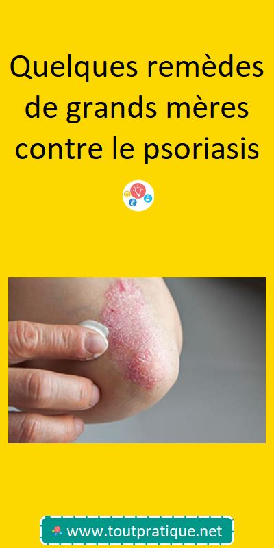 Quelques Remèdes De Grands Mères Contre Le Psoriasis Psoriasis Le