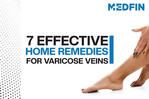 Ppt 7 Effective Home Remedies For Varicose Veins Varicose Veins