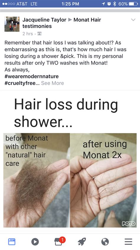 Top 48 Image Pictures Of Normal Hair Loss In Shower Thptnganamst Edu Vn