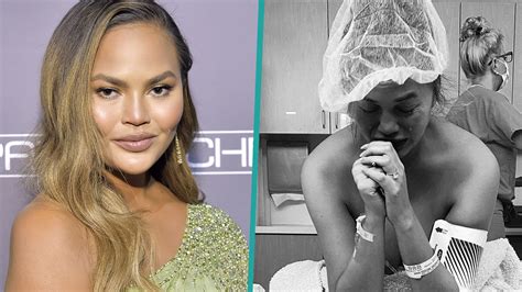 Chrissy Teigen Explains Decision To Post Photos Of Pregnancy Loss I Needed To Share This Story