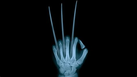 Cool X Ray Wallpaper 66 Images