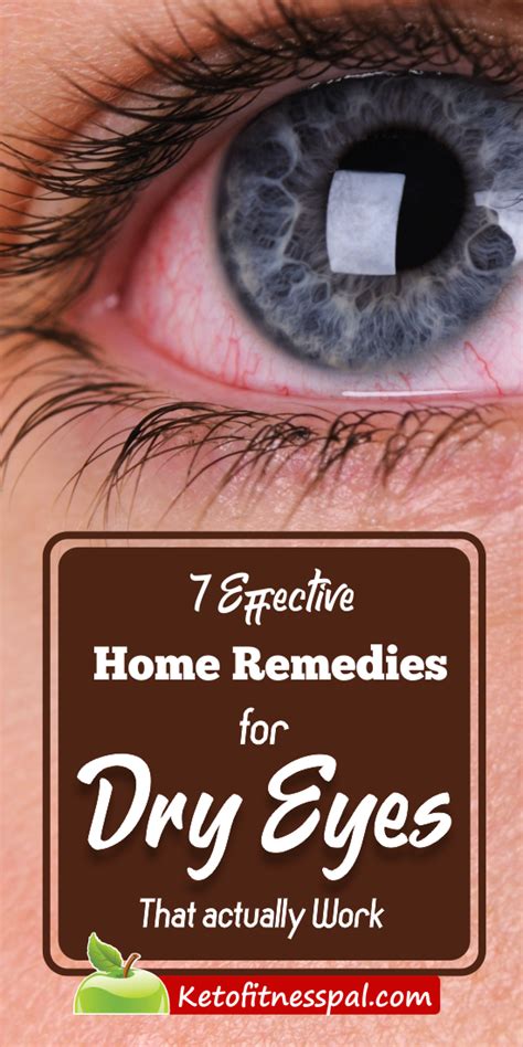 7 Effective Home Remedies For Dry Eyes That Work In 2020 Dry Eyes