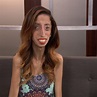 Lizzie Velasquez's Powerful Journey