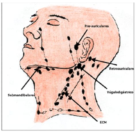 Ganglios Linfaticos Cuello Inflamados Seo Positivo