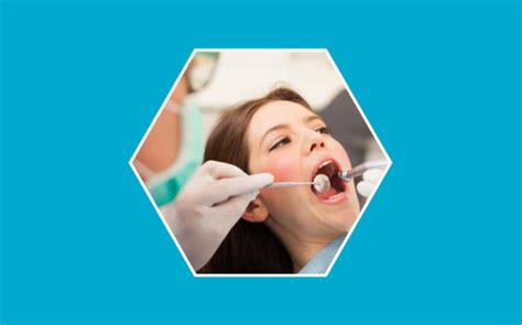 Curetaje Dental ¿en Qué Consiste Blog Doctorgo