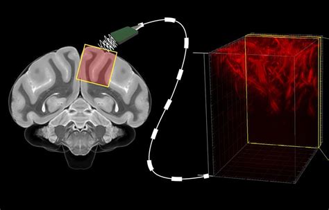 Reading Minds With Ultrasound Caltechs New Brainmachine Interface