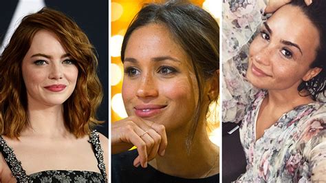 Meghan Markle And Other Stars Who Have Embraced Their Freckles Hello