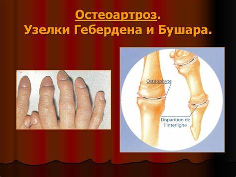 Дифференциальная диагностика суставного синдрома - online presentation Картинка - Дифференциальная диагностика суставного синдрома - online presentation