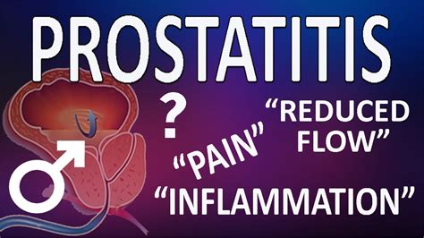 Prostatitis Prostate Inflammation Types Causes And Symptoms Youtube