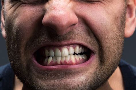What Is Bruxism Facty Health