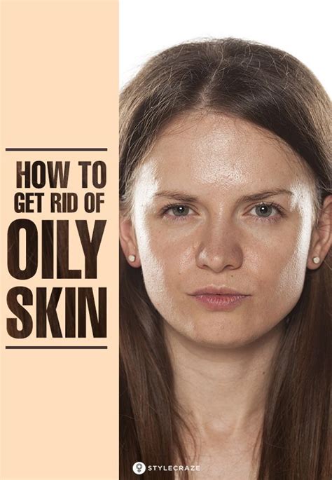 How To Get Rid Of Oily Skin 10 Effective Home Remedies Prevention Tips Oily Skin Treatment