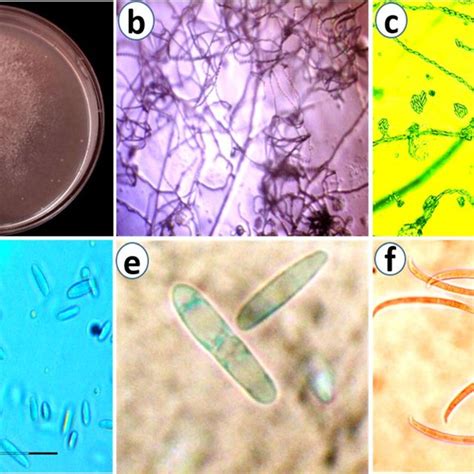 Morphological Characters Of Fusarium Falciforme A Colony Characters