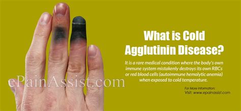 Cold Agglutinin Diseasecausessymptomstreatmentrisk