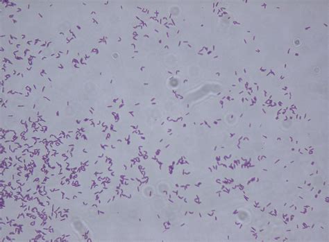 Gram Positive Coccobacilli Microbiology Learning The Whyology Of