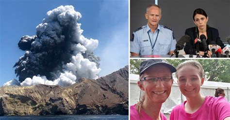 Volcano Victims So Badly Burned Skin Had To Be Shipped In From Abroad
