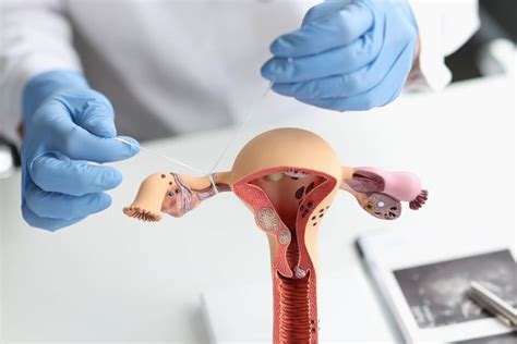 How Does Female Sterilization Work Ob Gyn Specialists Of South Miami