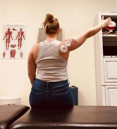 Understanding Cupping Therapy The Benefits And How It Works