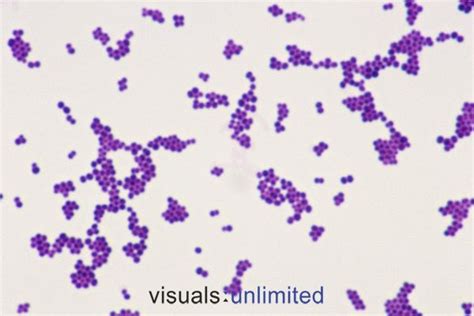 Gram Positive Cocci In Clusters 10 Best Images About Staphylococcus