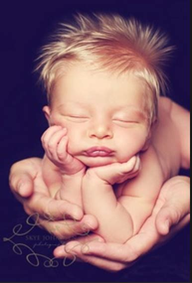 Viral Birth Photos Show Beautiful Stunning Conehead Baby Phenomenon