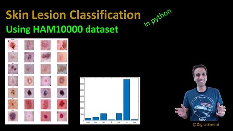 203 skin cancer lesion classification using the ham10000 dataset youtube