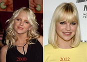 Anna Faris before and after plastic surgery 01 – Celebrity plastic ...