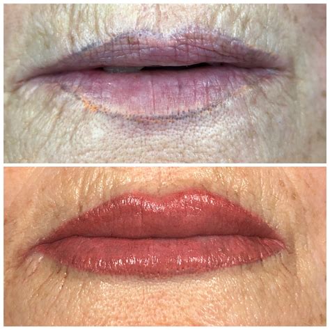 Because the procedure is done in two appointments, the lips are permanent makeup uses various forms of tattoo inks that are toxic to the body; Lip Tattooing | Tattoo Lips Permanent Makeup | Cosmetic ...