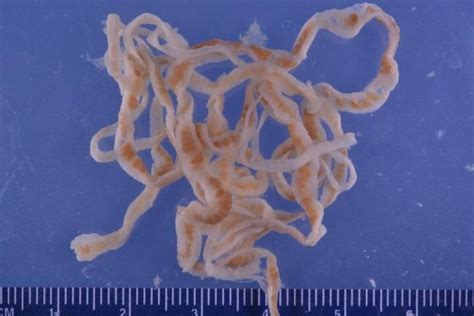 Scientists Discover Mechanisms That Protect Tapeworms From Being