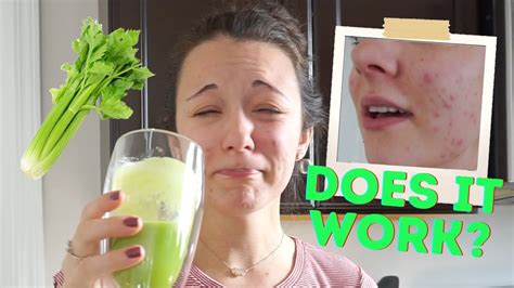Celery Juice Hormonal Acne Trying Celery Juice For The First Time