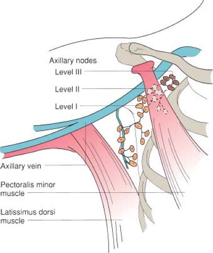 Axillary Node Dissection Basicmedical Key
