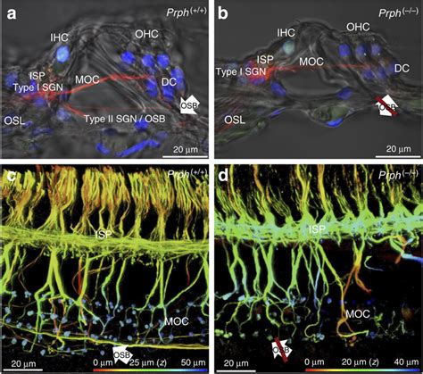 Loss Of Afferent Innervation Of Outer Hair Cells Ohc In Prph−−