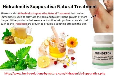 Herbal Supplements For Hidradenitis Suppurativa Natural Treatment