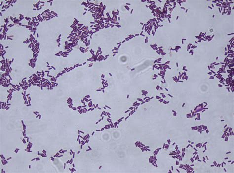 Bacillus Subtilis Gram Stain Bacillus Subtilis Microbiology Bacillus