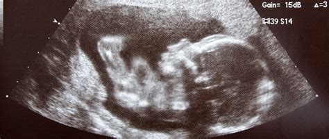 Keepsake Ultrasounds American Pregnancy Association