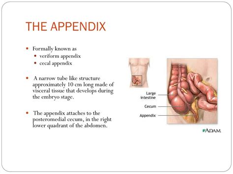 Ppt Appendicitis Powerpoint Presentation Free Download Id2176545